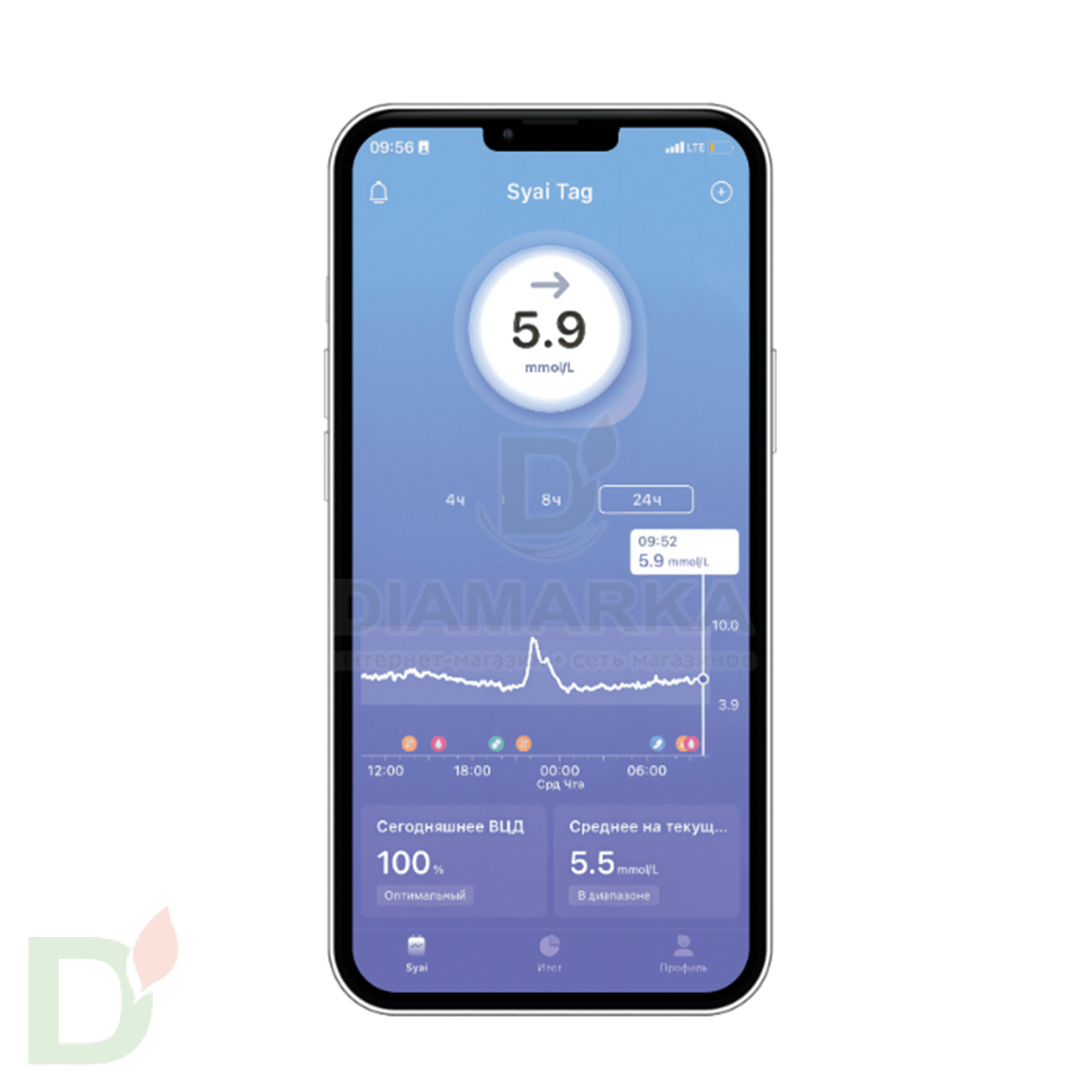 Сенсор (датчик) Syai X1 Сенсор (датчик) Syai X1